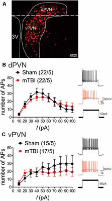 Blast-Induced Mild Traumatic Brain Injury Alterations of Corticotropin-Releasing Factor Neuronal Activity in the Mouse Hypothalamic Paraventricular Nucleus